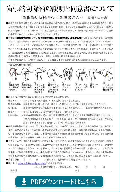 歯根切除術の説明と同意書について